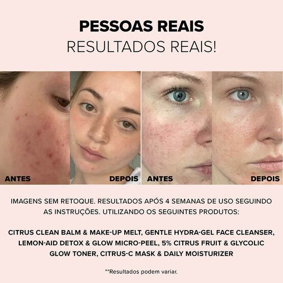 NUDESK EXFOL. DETOX&GLOW MICRO-PEEL60ML